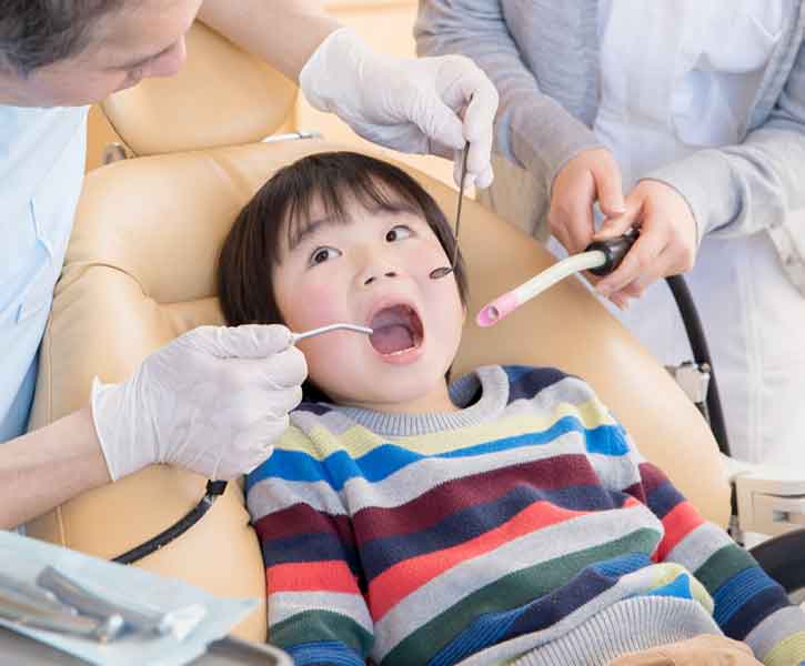 お子様の虫歯の治療