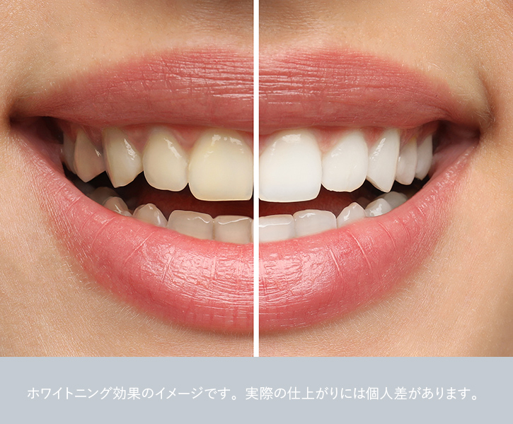 効果が持続しやすい