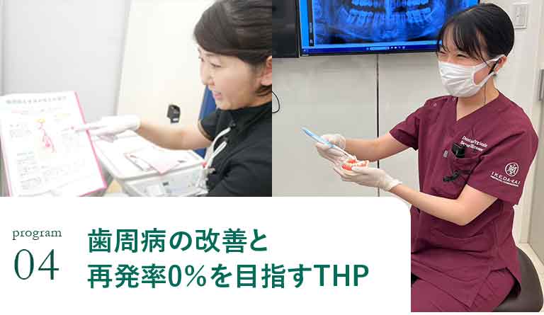 歯周病の改善と再発率0％を目指すTHP