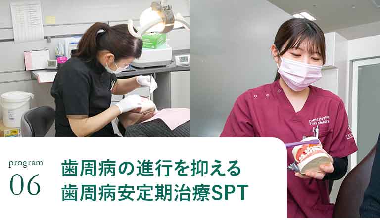 歯周病の進行を抑える歯周病安定期治療SPT